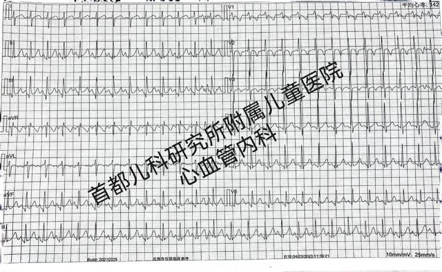 【动态】首儿所心脏内外科联手矫治儿童右心耳持续性房性心动过速