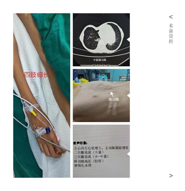 【动态】1+1＞2，首儿所多科室联合手术治疗<span id=