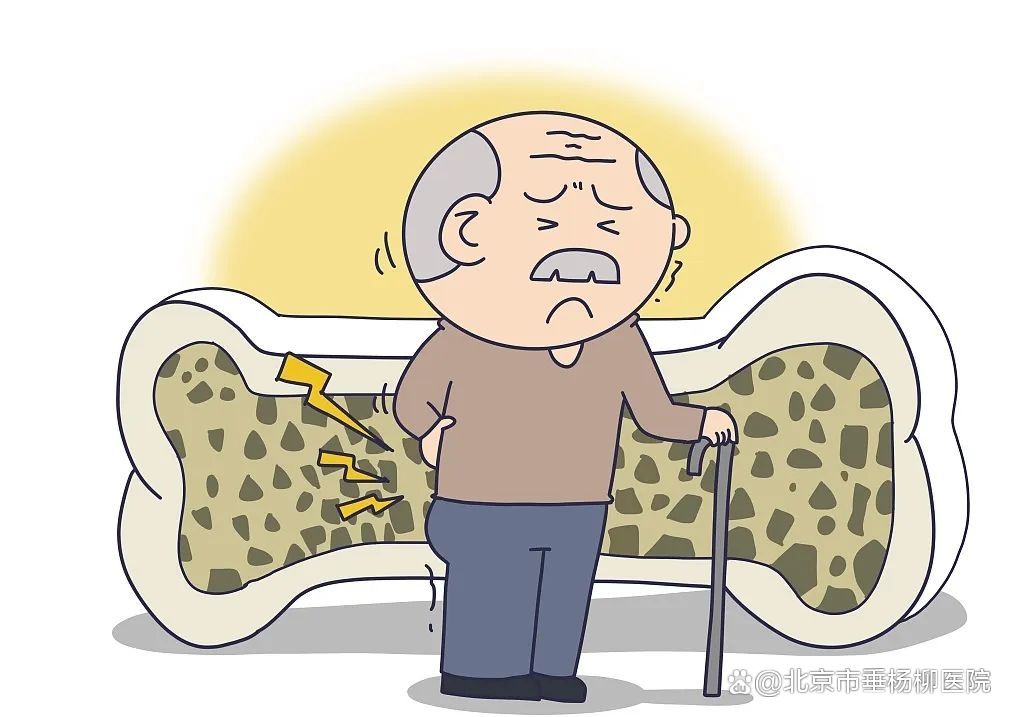 垂医科普 | 内分泌科:强健骨骼,拒绝“疏松”