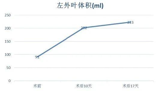 【首儿医典】肝母细胞瘤