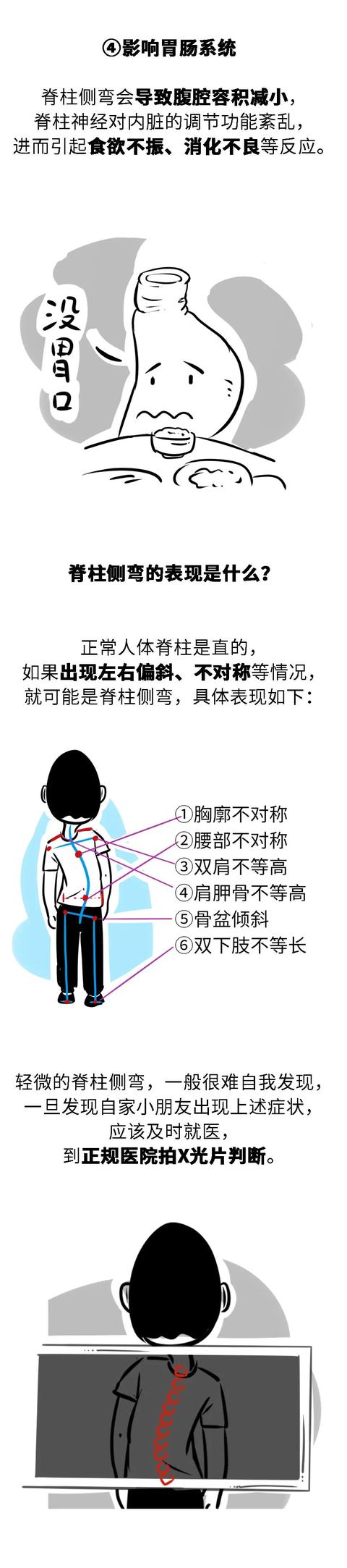 【热点】这些不良习惯会导致脊柱侧弯，中小学生家长请务必警惕！