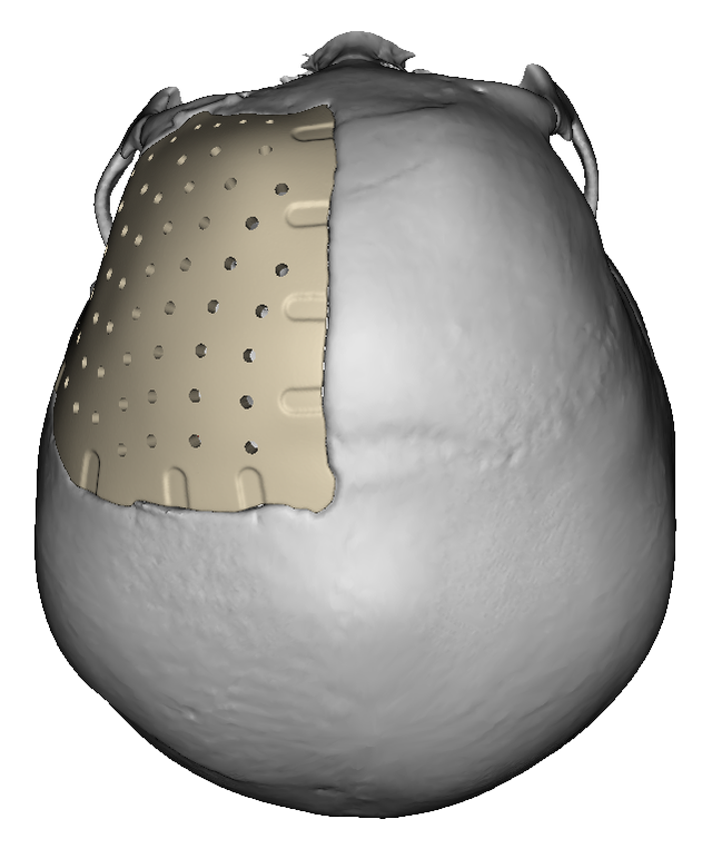 【动态】首儿所多学科协作抢救4岁坠楼女童