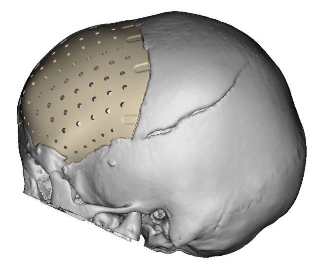 【动态】首儿所多学科协作抢救4岁坠楼女童