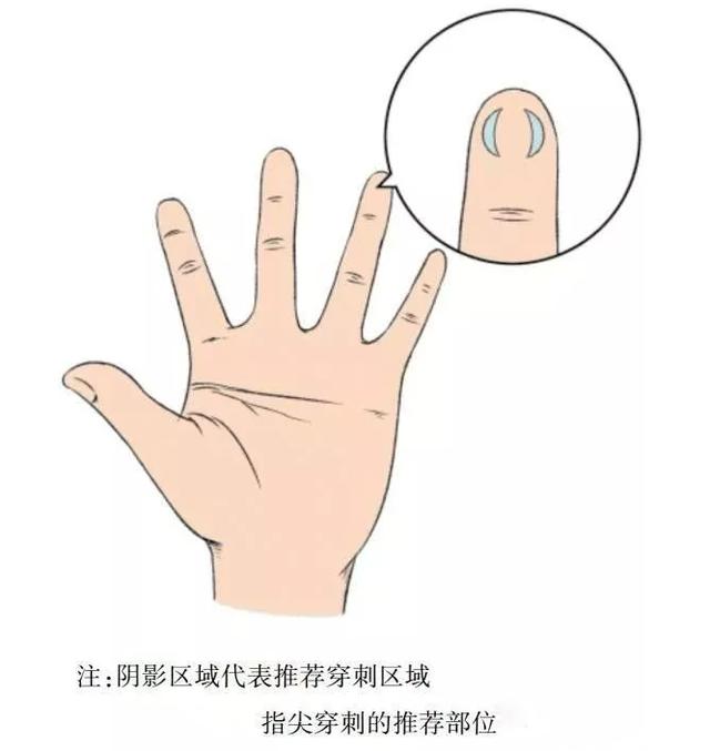 【首儿e科普】正确采集末梢血，家长和检验师要密切配合
