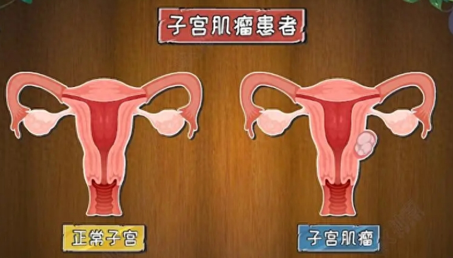 【汤医科普】尿频，竟是因为它？