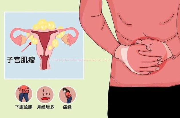 【汤医科普】尿频，竟是因为它？