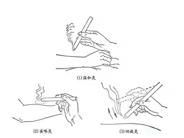 【汤医科普】且行且珍“膝”，艾灸来助力