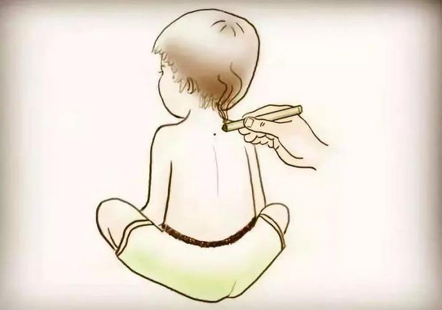 【汤医科普】儿童青少年近视防控与中医治疗