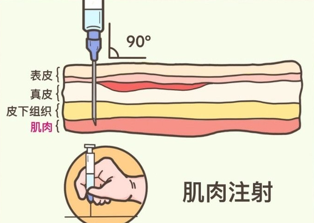 【汤医科普】肌肉注射常识，你了解多少