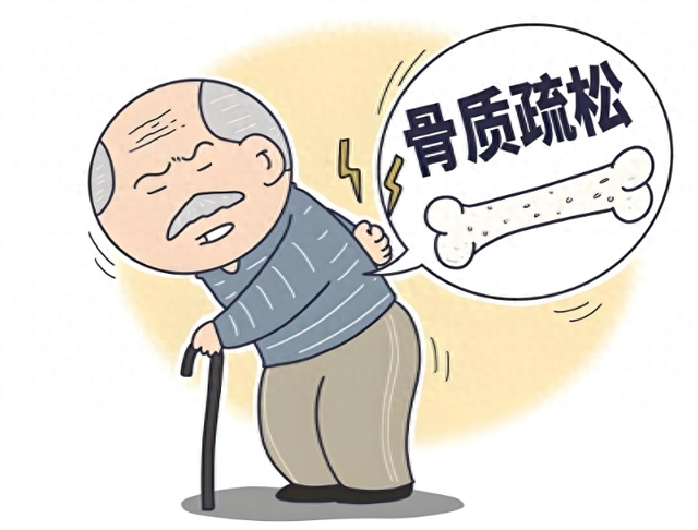 【汤医科普】骨质疏松患者如何健康减重