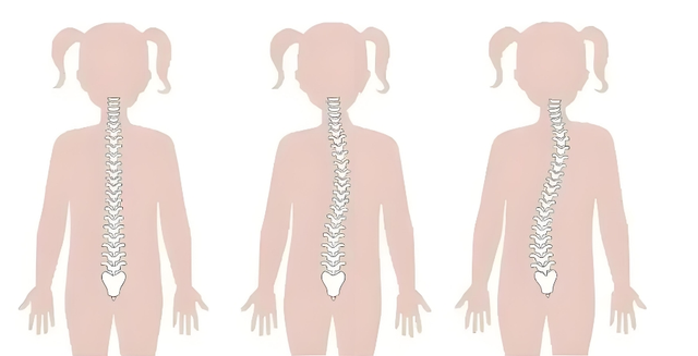 【就诊指南】500万孩子被“它”偷走了身高！如何发现这种疾病？