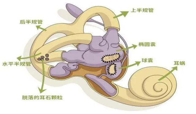 【汤医科普】“小石头”引发的大眩晕