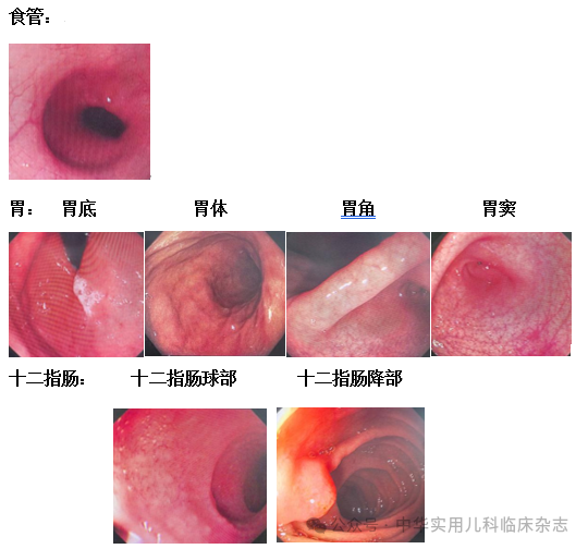 【热点】儿童胃镜检查十问十答