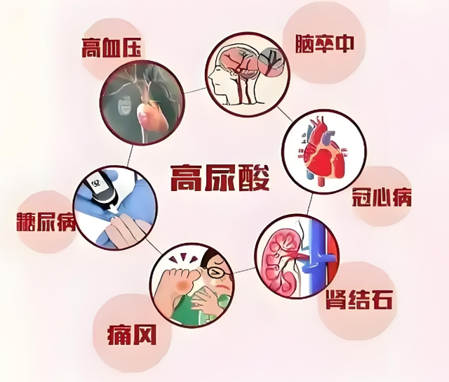 【健康管理】当您拿到一份体检报告....
