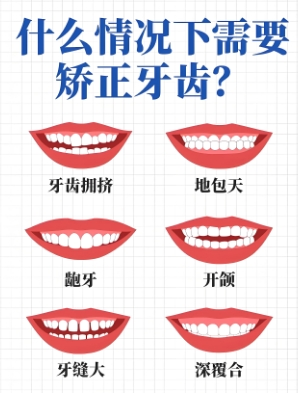 【汤医科普】孩子什么时候该做正畸？医生告诉你别错过“黄金期”！