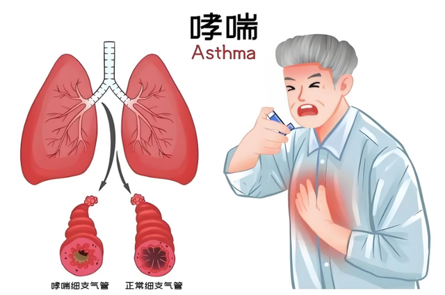 【汤医科普】老年呼吸系统疾病特色治疗——三伏贴